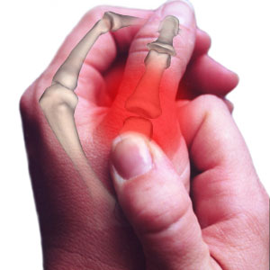 Thumb pain